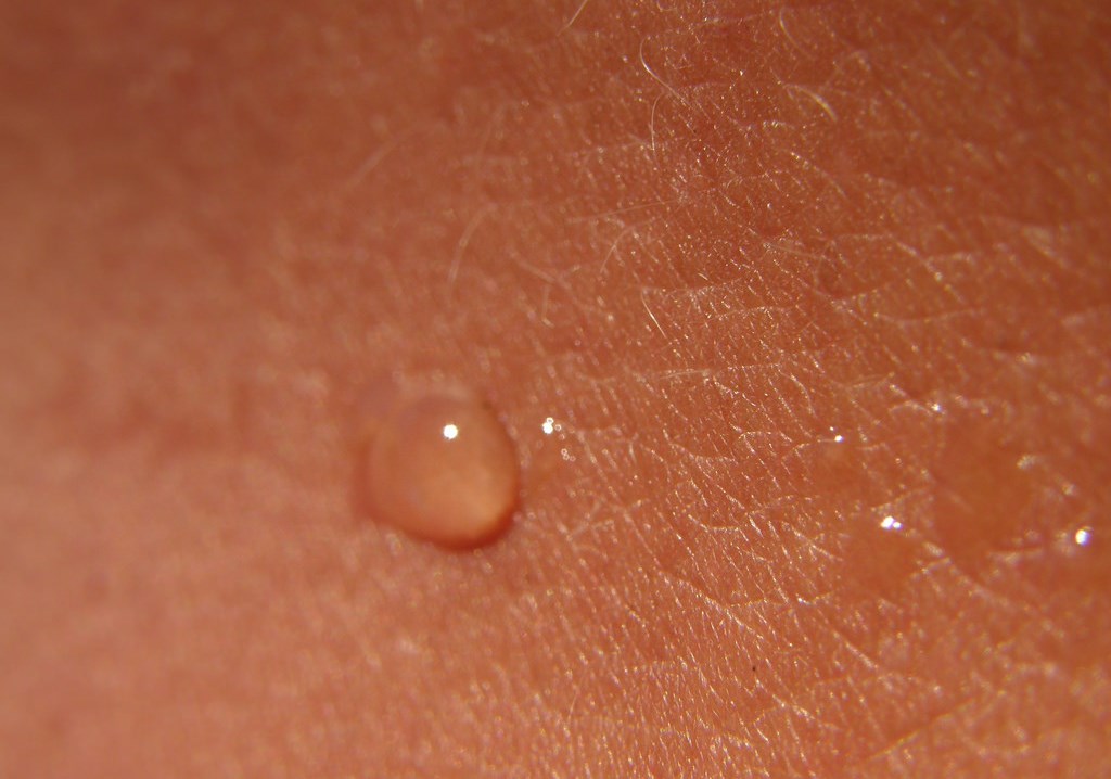 skin